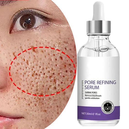 Sérum Retinol 0.3% + Niacinamida 10% — Anti-Aging Noche
